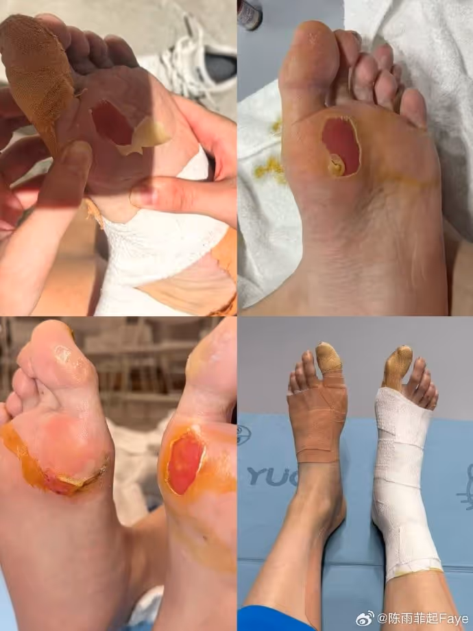 陈雨菲脚磨破皮：让未完成的遗憾留在这里吧  我问心无愧